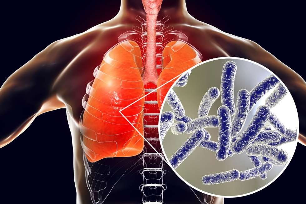 Cuestiones frecuentes sobre el Real Decreto 487/2022 contra la legionella